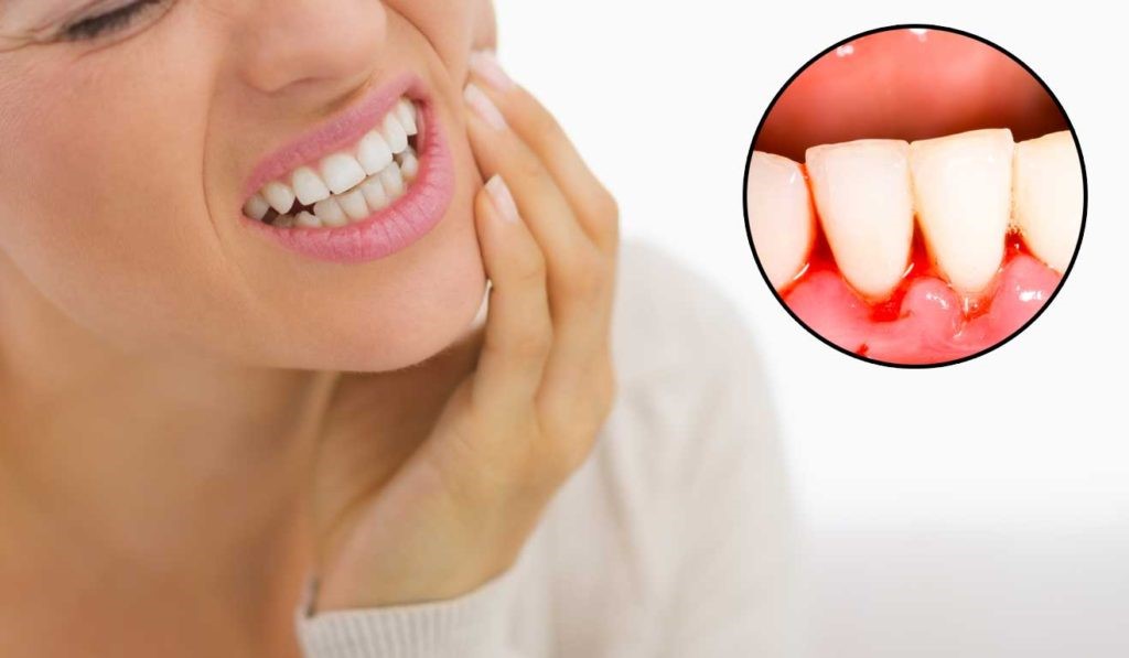Chảy máu chân răng báo hiệu cơ thể thiếu vitamin c